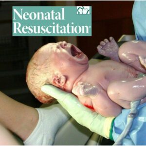 Neonatal resuscitation for babies