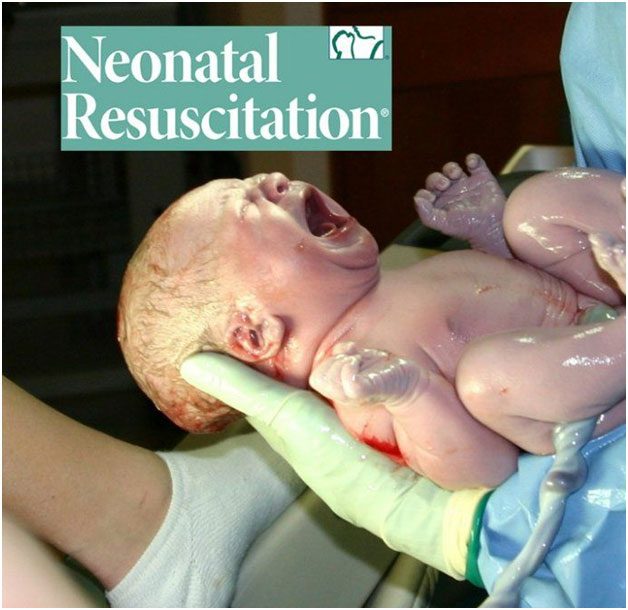 Neonatal resuscitation for babies
